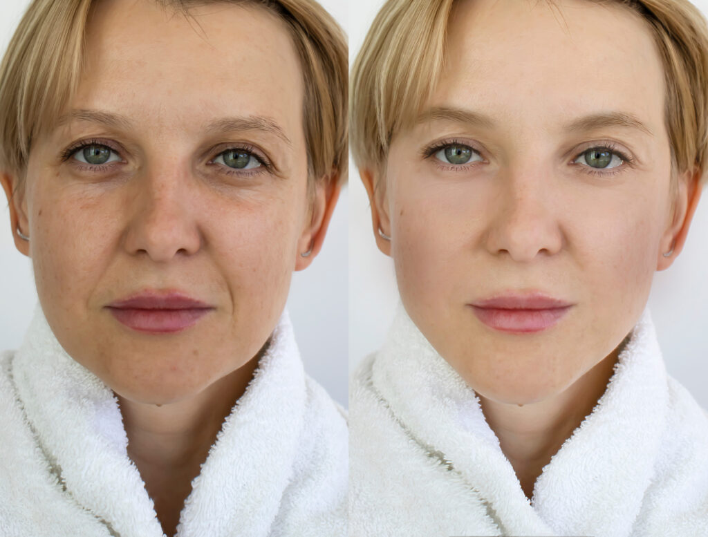 pelle asfittica beauty routine