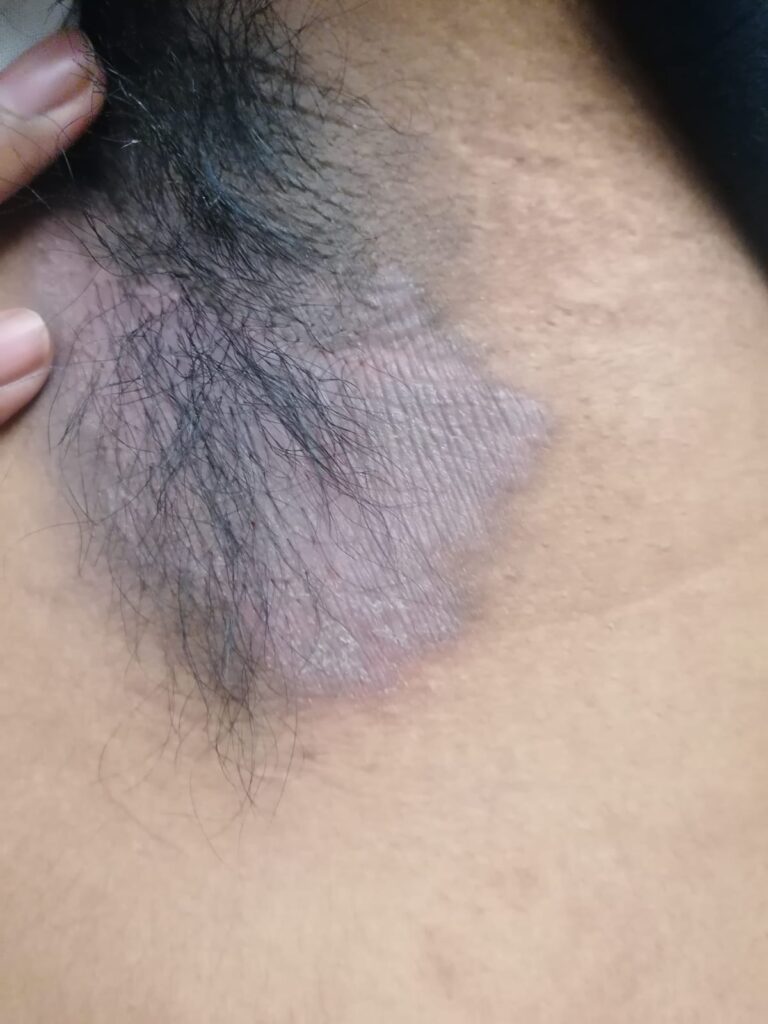 PrimaT0