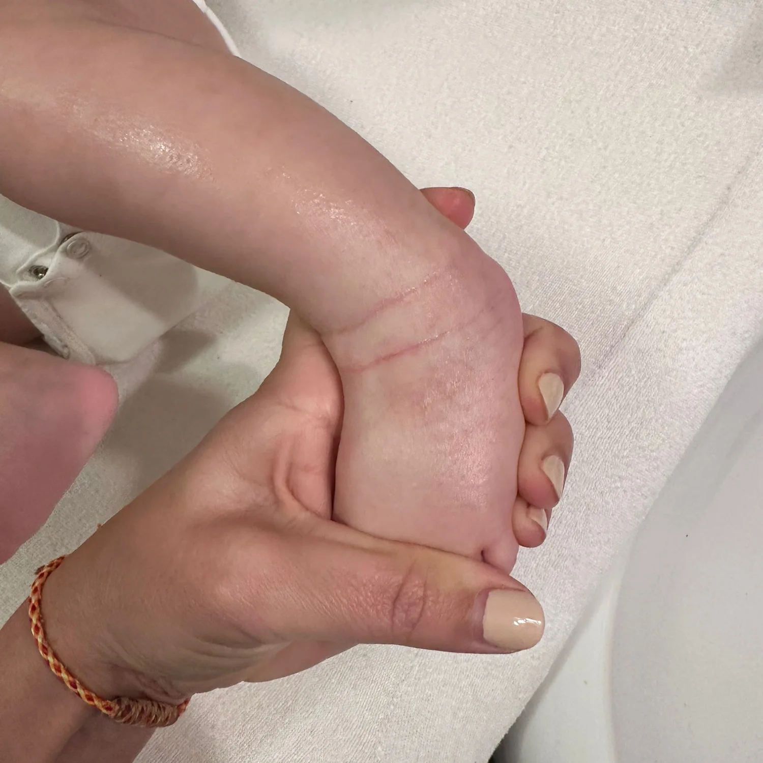 ixbiota-dermatite-atopica-bambino