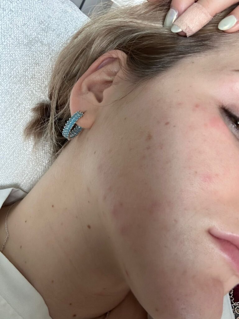 Annalisa.Acne.T0