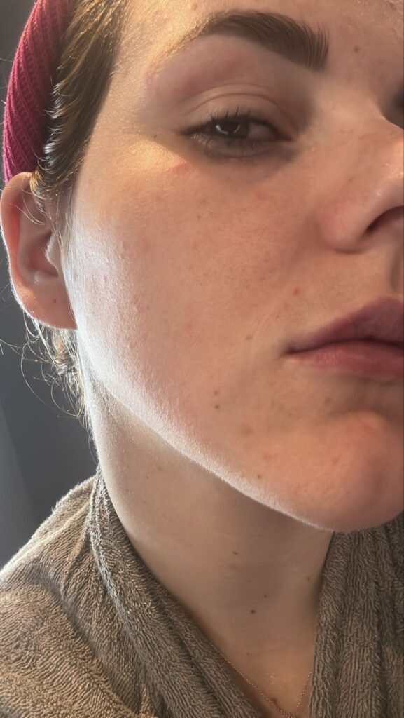 Annalisa.Acne.T1